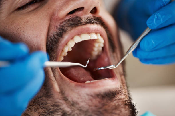 Emergency Dental Services in Cuero, TX